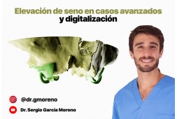 Curso online Elevación de seno en casos avanzados y digitalización por Dr. Sergio Moreno